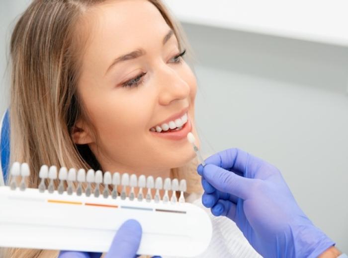 How to Care for Your Dental Veneers: Expert Tips for Longevity