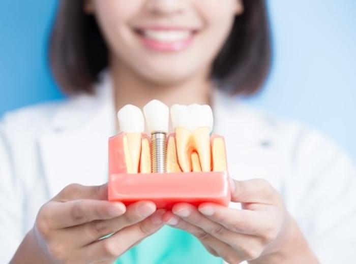 The Importance of Post-Implant Care: Choosing the Right Team for Long-Term Success