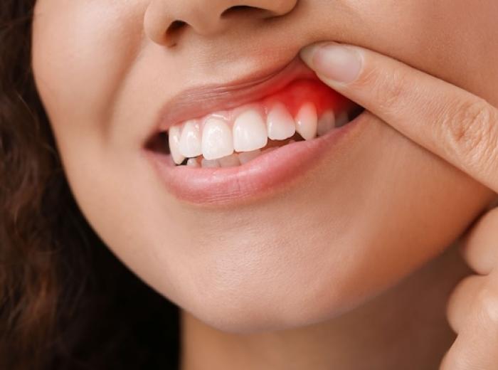 Essential Strategies for Healthy Gums: Why Hall Family Dentistry Stands Out