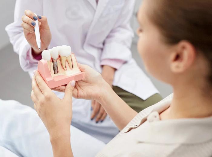 What is a Dental Implant’s Timeline? | Dentist Southeast Indianapolis